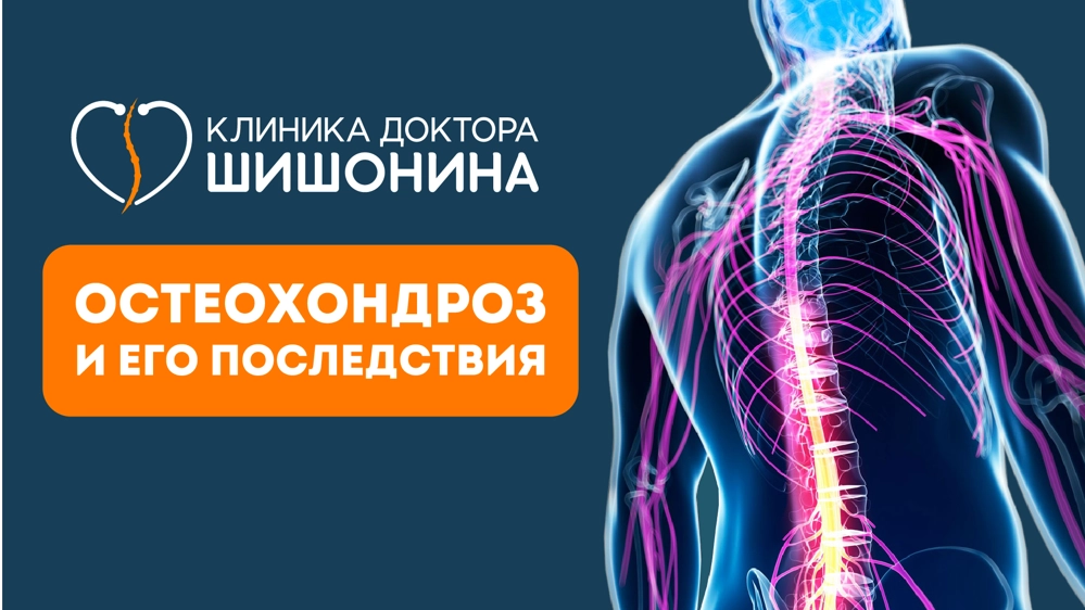Как эффективно лечить остеохондроз без операций