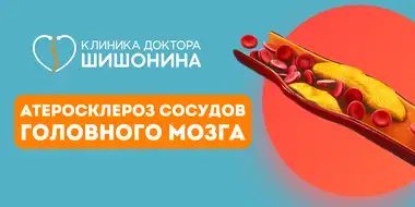 Атеросклероз сосудов головного мозга