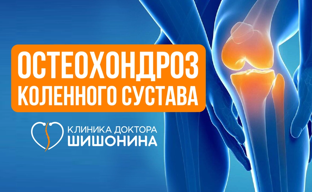 Лечение остеохондроза коленного сустава