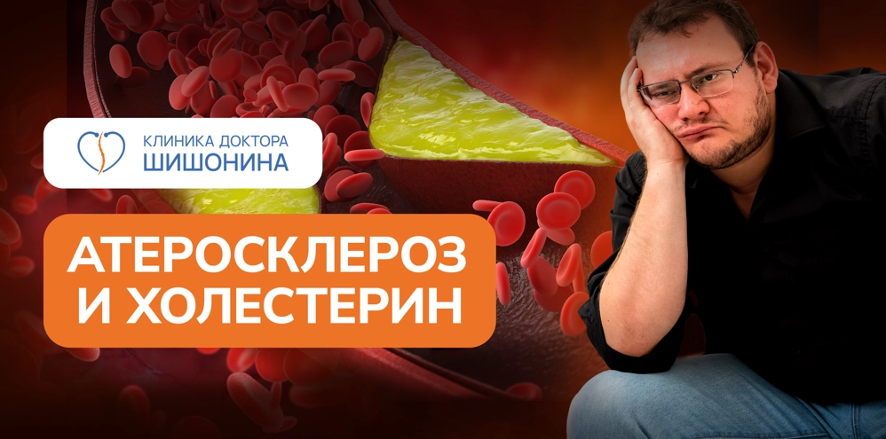 Атеросклероз и холестериновые бляшки