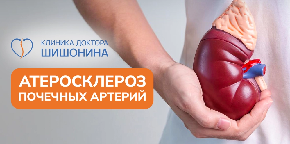 Суть атеросклероза почечных артерий