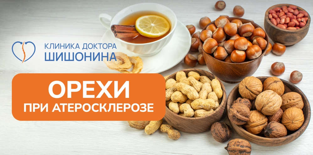 Польза и вред орехов при атеросклерозе