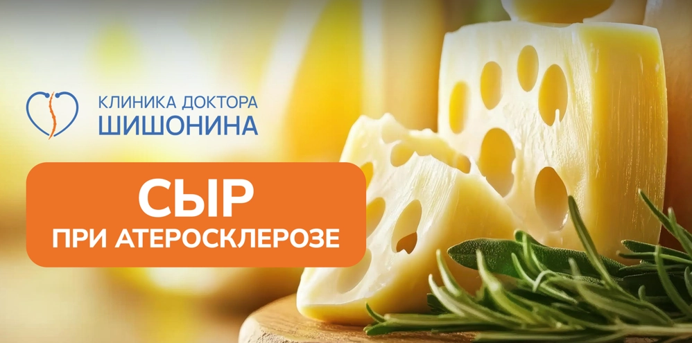 Польза и вред сыра при атеросклерозе