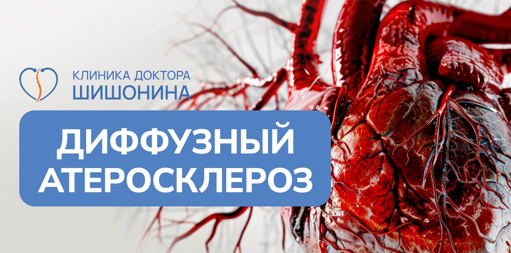 Заболевание диффузный атеросклероз