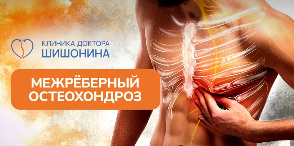 Лечение межреберного остеохондроза