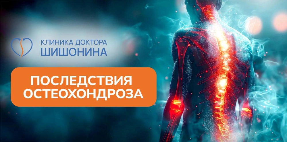 Основные последствия остеохондроза