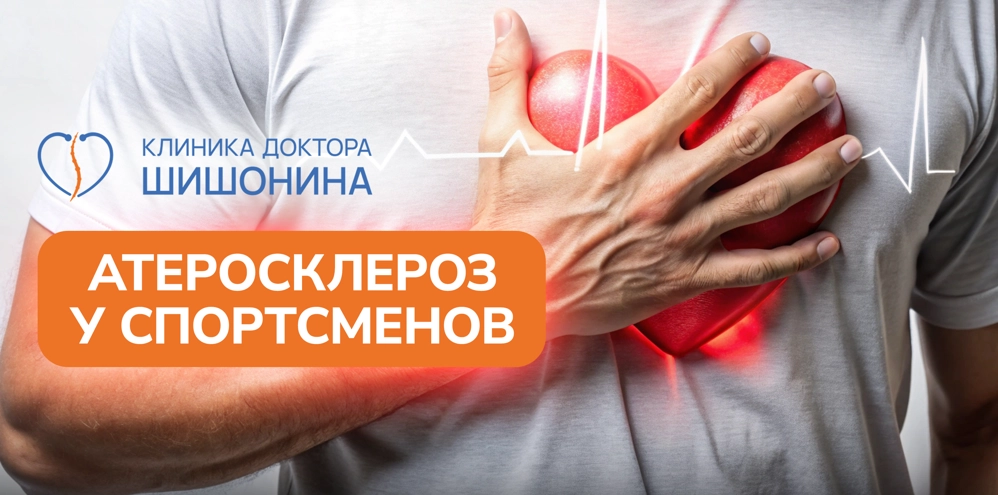 Нагрузка спортсменов при атеросклерозе