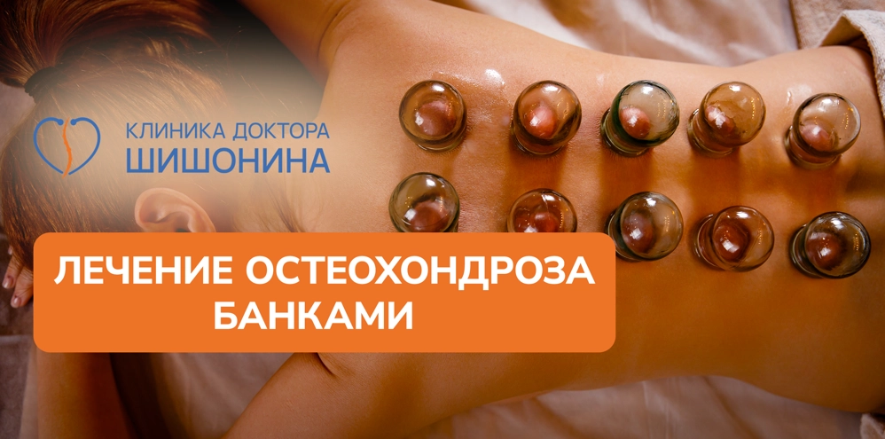 Лечение банками при остеохондрозе