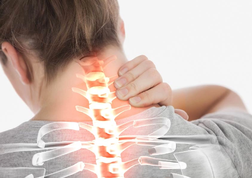 Фото женщины с шейным остеохондрозом