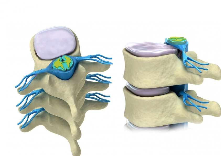 Изображение позвонков и межпозвоночных дисков