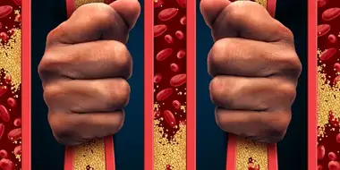 Жирная пища для лечения атеросклероза