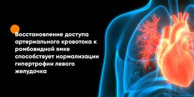 Статья Восстановление доступа артериального кровотока