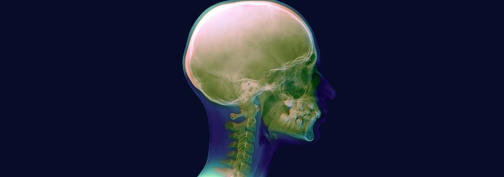 Фото исследований скоростей восстановления хряща шейного отдела позвоночника благодаря кровотоку