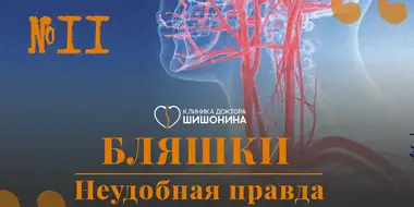 Атеросклеротические бляшки