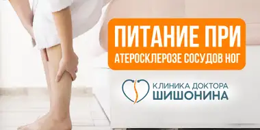 Питание при атеросклерозе сосудов