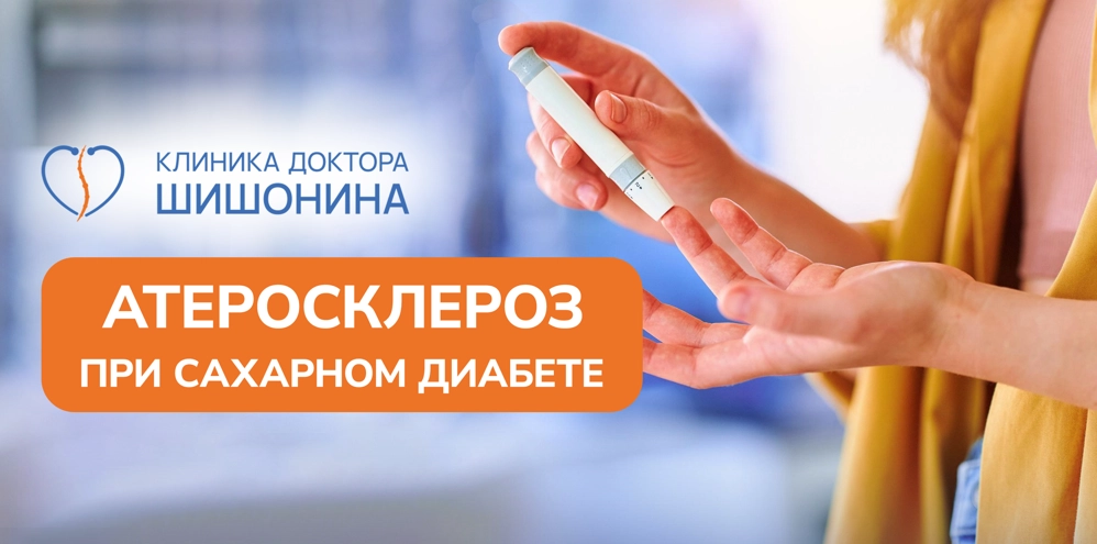 Связь атеросклероза и сахарного диабета