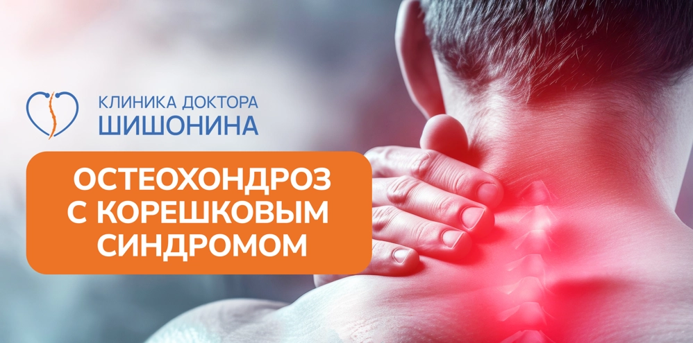Лечение остеохондроза с радикулопатией