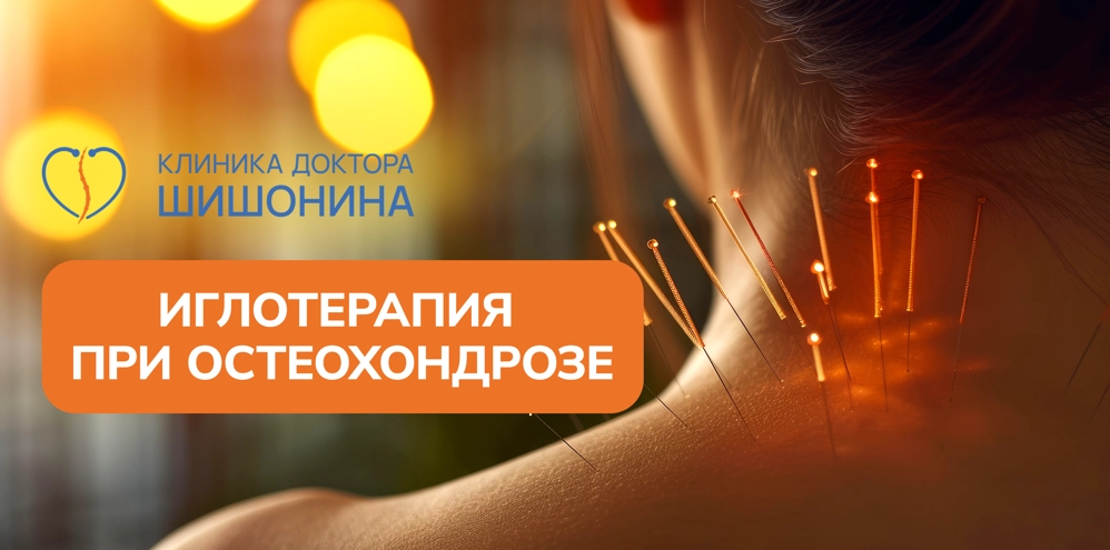 Акупунктура при остеохондрозе