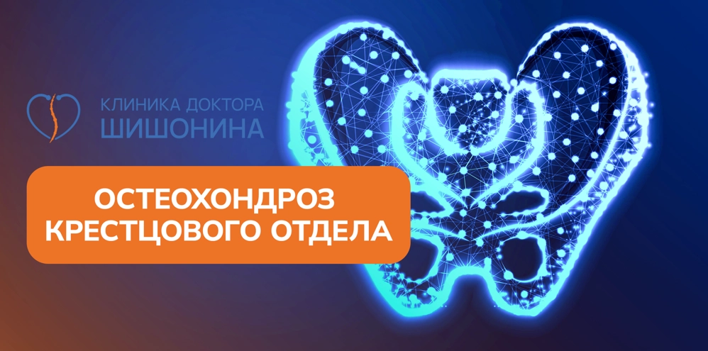 Лечение остеохондроза крестцового отдела