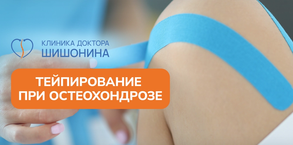 Лечение остеохондроза тейпированием