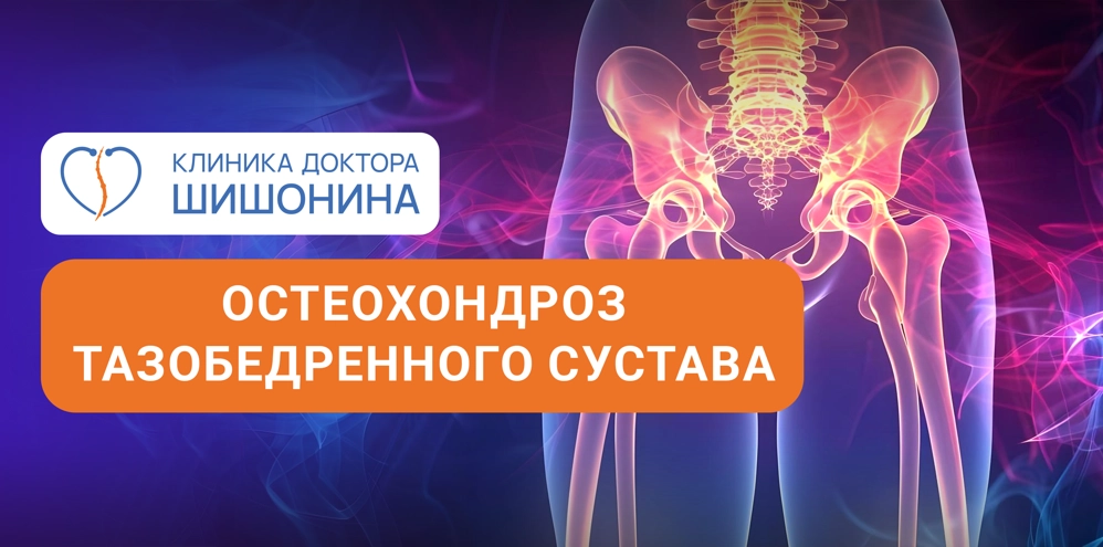 Лечение тазобедренного остеохондроза