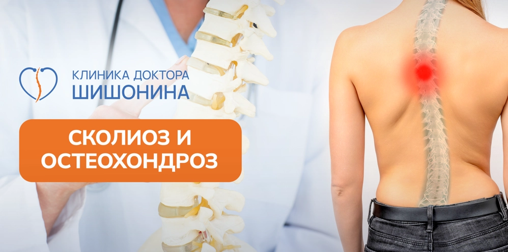 Осложнения сколиоза при остеохондрозе