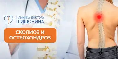 Осложнения сколиоза при остеохондрозе