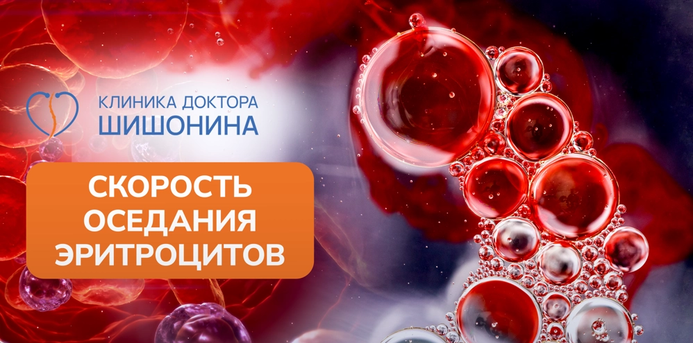 Повышение СОЭ при остеохондрозе