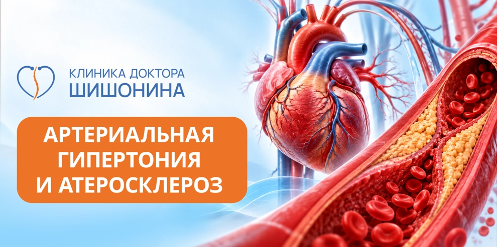 Фото к статье про артериальную гипертонию и атеросклероз