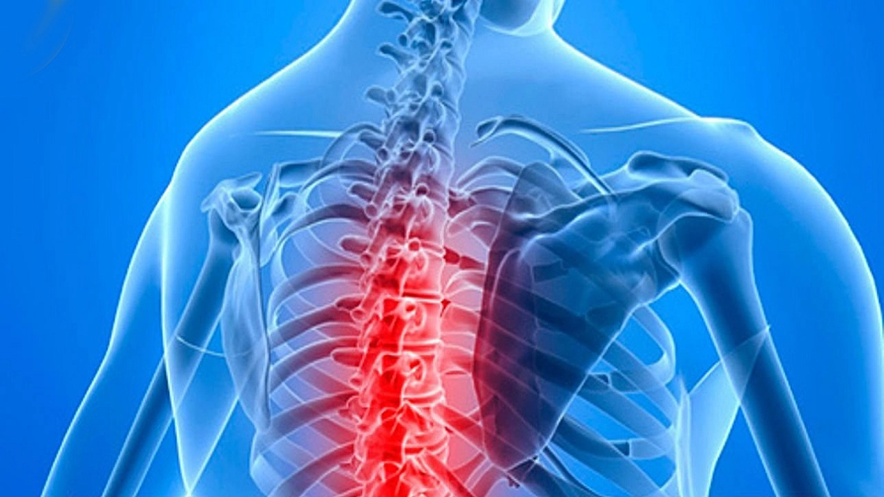 Остеохондроз грудного отдела