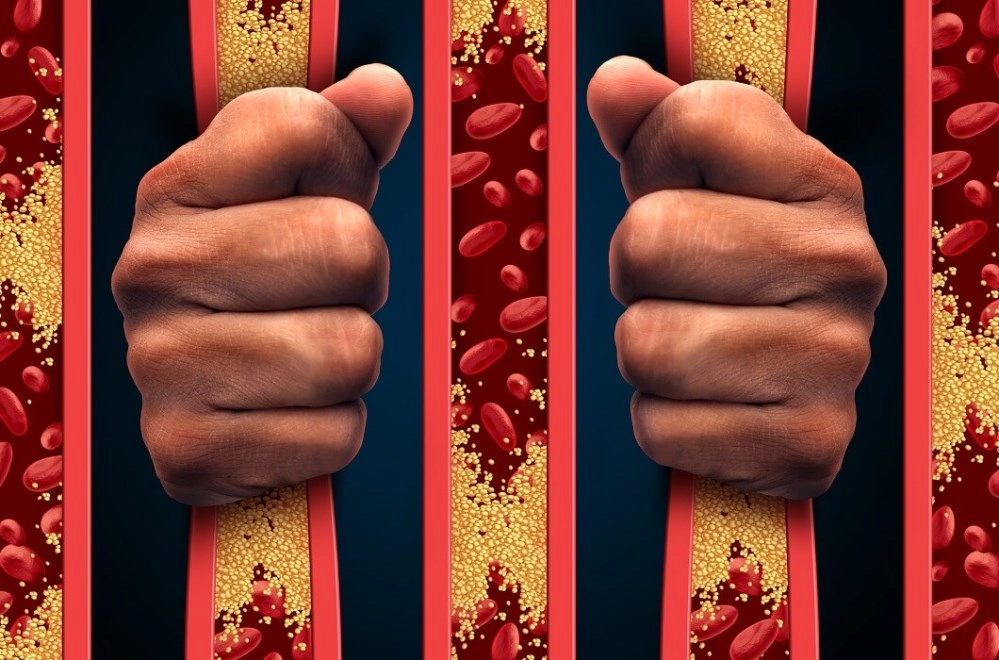 Жирная пища для лечения атеросклероза