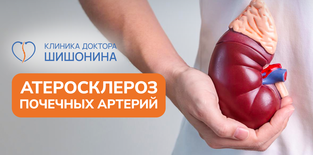 Суть атеросклероза почечных артерий