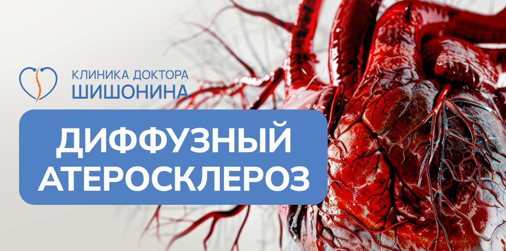 Заболевание диффузный атеросклероз