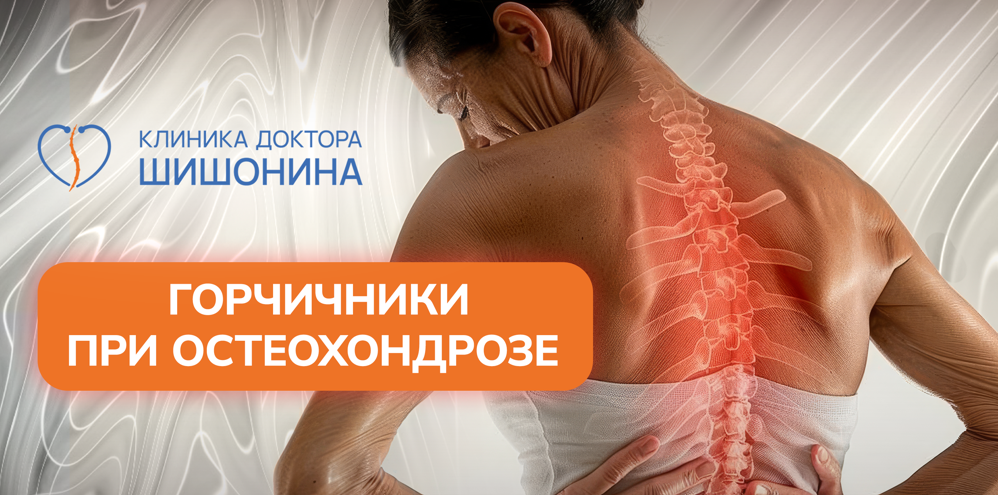 Лечение горчичниками при остеохондрозе