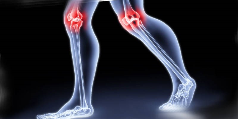Формы коленного остеохондроза
