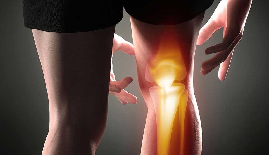 Лечение остеохондроза коленного сустава