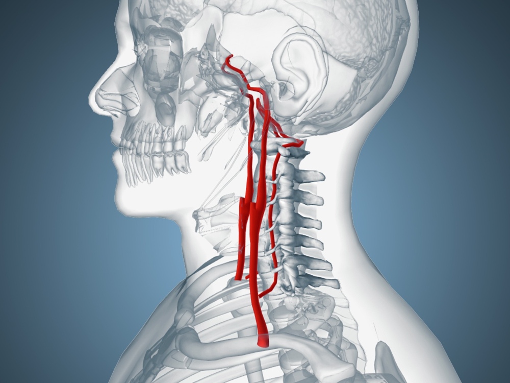 Статья про Роль кровотока в шейных позвоночных артериях
